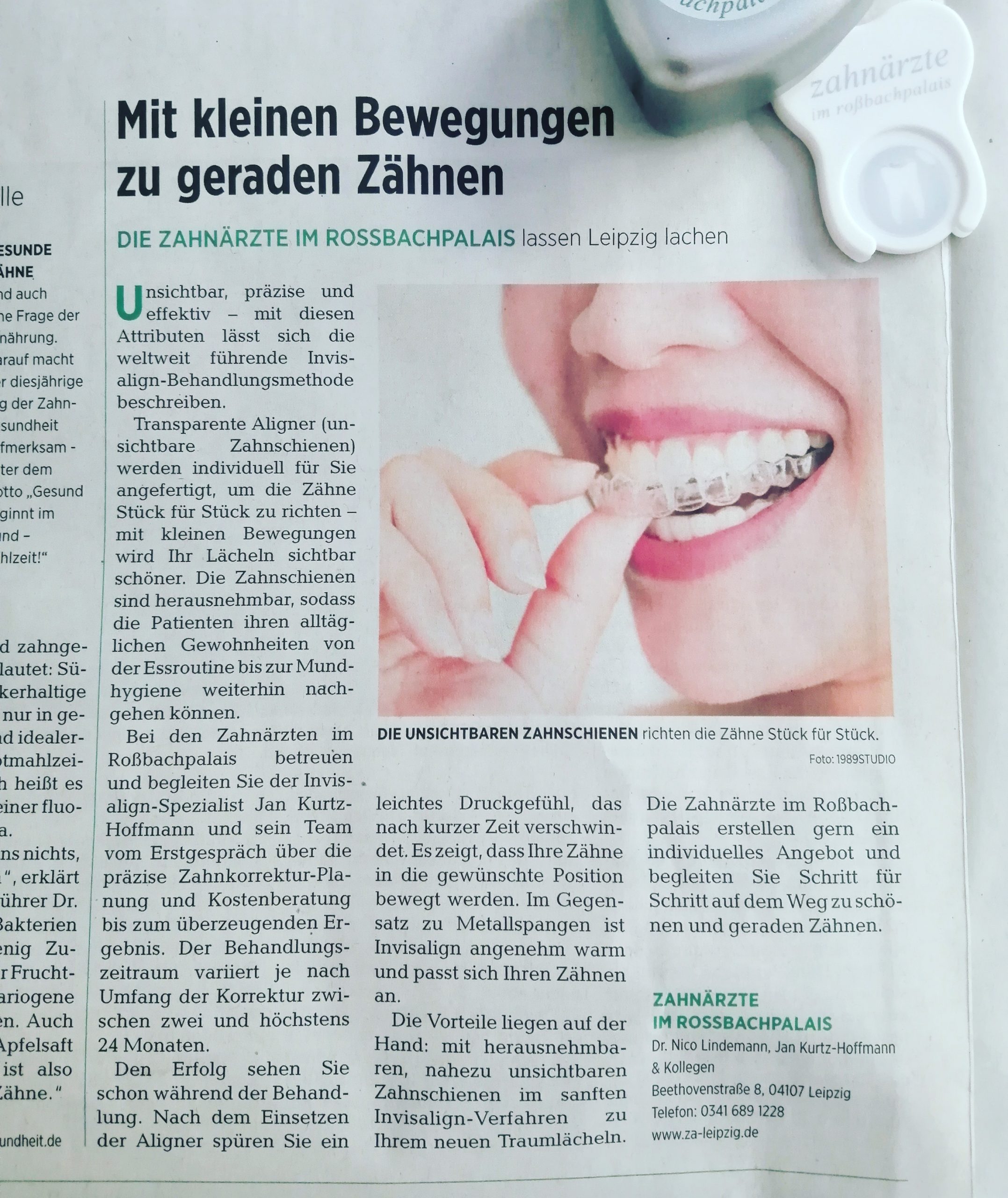Mit kleinen Bewegungen zu geraden Zähnen